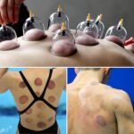 Cupping Kit for Massage Therapy - 32 Cups Professional Chinese Cupping Set with Magnetics, Vacuum Cupping Therapy Set for Cellulite Reduction Muscle Pain Relief with Manual Pump - Image 5