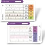 EKG Rhythm Interpretation Card-with 3X Pocket Magnifier &Badge Holder- Quick ECG Reference Guide for KardiaMobile- Durable Plastic-Nurse Gifts-for Horizontal & Vertical-2 Cards Upgraded Bigger Text - Image 2